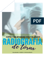 Radiografía de Torax. AYUDANTE MEDICO