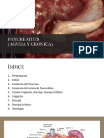 Pancreatitis Aguda y Crónica
