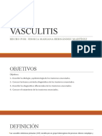 Vasculitis