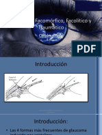127937551-Glaucoma-Facomorfico-Facolitico-y-Traumatico