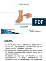 Edema