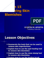 Photoshop Lesson 15 - Removing Skin Blemishes