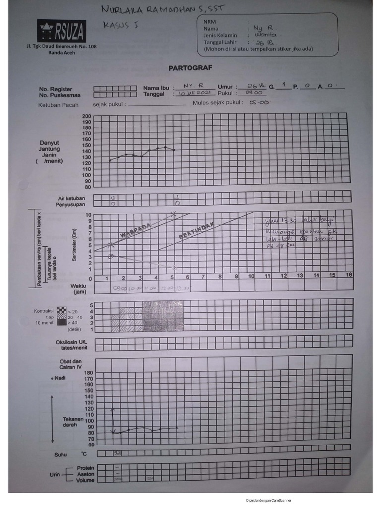 Partograf | PDF