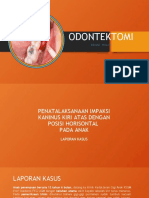 Odontektomi