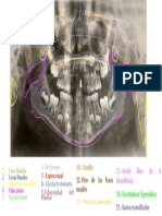 LilianaG - Trazado y Análisis de La Ortopantomografía