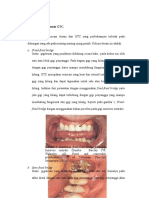 Pdfcoffee.com Macam Macam Desain Gtc a Fixed Fixed Bridge PDF Free