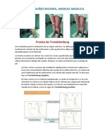 Prueba de Trendelemburg