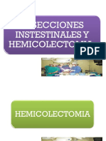 Presentacion de Hemicolectomia y Colostomia 2015