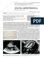 Dialnet-MiocardiopatiaHipertrofica-6286006 