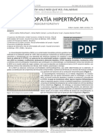 Dialnet MiocardiopatiaHipertrofica 6286006