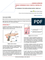 Hiperhidrosis E Iontoforesis. Experiencia en El Hospital Central de La Defensa "Gómez Ulla"