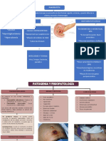 Pancratitis