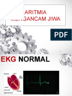 Aritmia Yang Mengancam Jiwa For Btcls