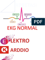 Ekg Normal