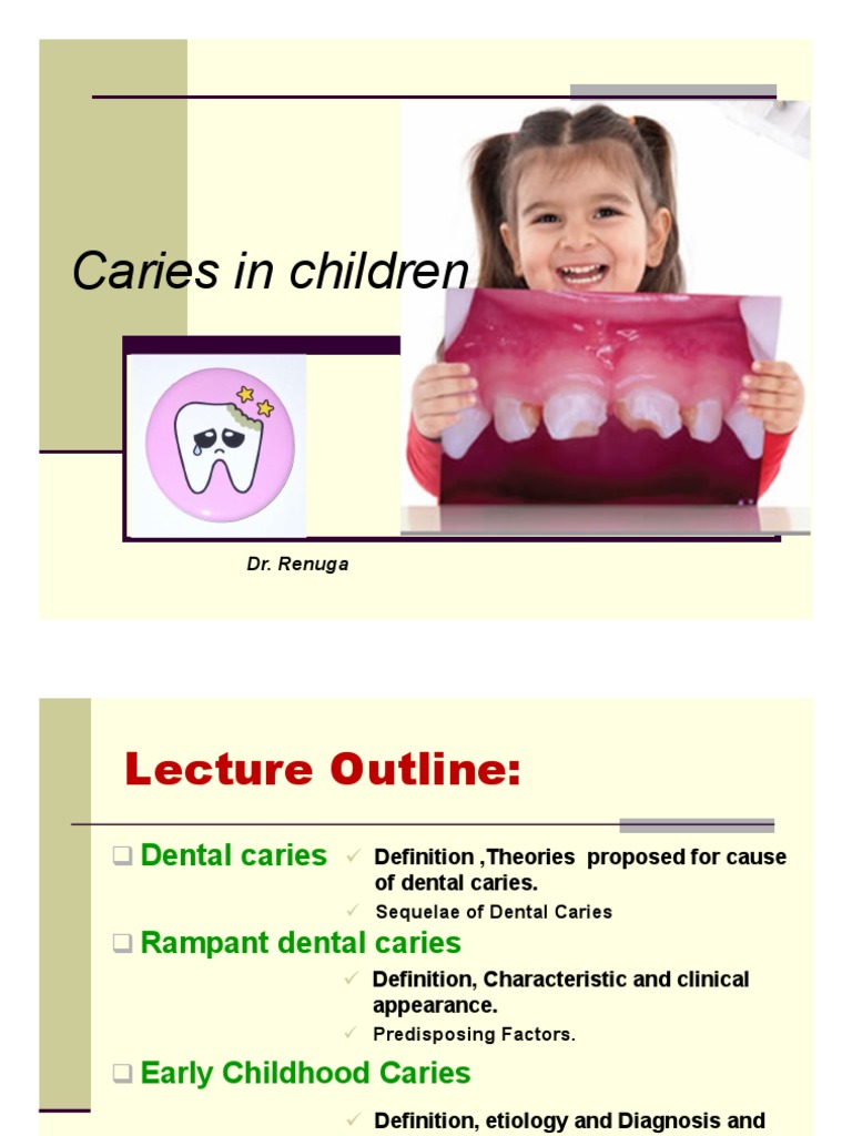 433PDS - Dental Caries in Children | PDF | Human Tooth | Health Sciences
