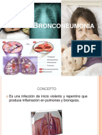 Bronconeumonía: causas, síntomas y tratamiento