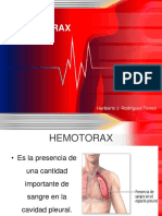 Hemotorax 110419223009 Phpapp02
