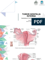 DT Tumor genitalia interna