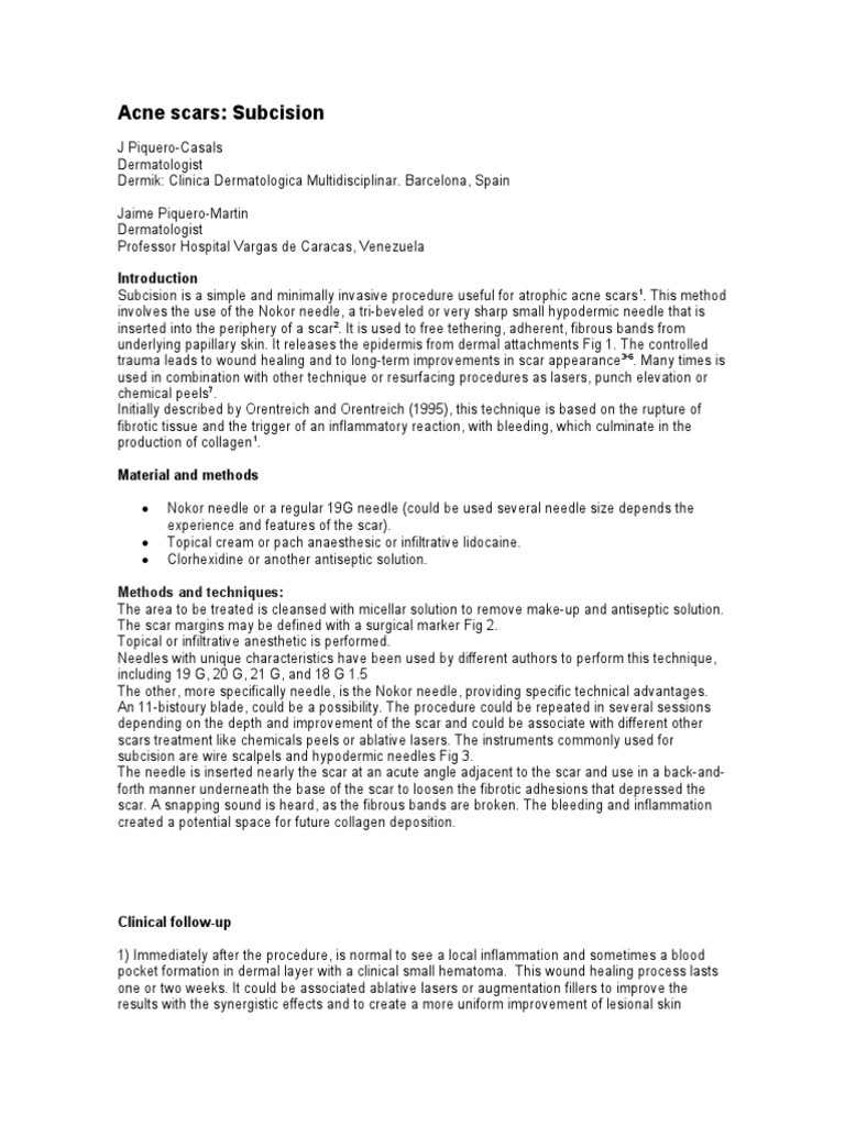 Subcision Technique for Acne Scars | PDF | Scar | Medicine