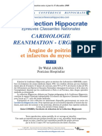 I-9-132-Angine de poitrine et infarctus du myocarde