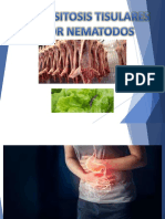 Parasitosis Tisulares Por Nematodos Olol