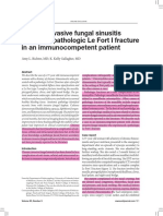 Chronic Invasive Fungal Sinusitis