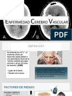 Nfermedad Erebro Ascular