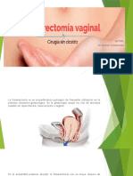 Histerectomía Vaginal NELSON