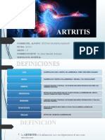 Artritis & Artritis Reumatoidea