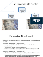 Hipersensitif Dentin