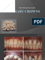 Temporary Crowns 5.3 2021