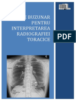Ghid de Buzunar Pt Interpretarea Radiografiei Toracice 2013