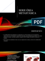 Serie Osea Metastasica