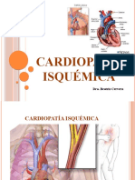 Cardiopatía Isquémica 0811