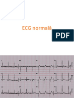 ECG Normala Seminar