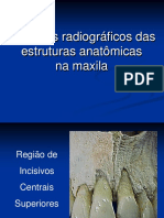 Aspectos radiográficos estruturas maxila