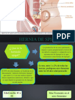 Hernia de Spigel