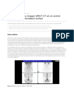 Importancia de La Imagen Spect CT en El Control Evolutivo de La Artrodesis Lumbar