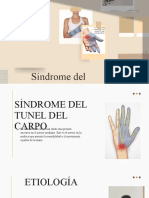 Síndrome Del Tunel Del Carpo