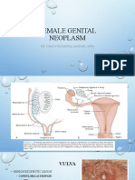Female Genital Neoplasm
