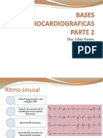 BASES ELECTROCARDIOGRAFICAS PARTE 2 - Argelin Rojas