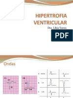 HIPERTROFIA VENTRICULAR - Argelin Rojas