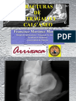 7164432 Clase de Fracturas de Calcaneo y Astragalo 130703063103 Phpapp01 (1)