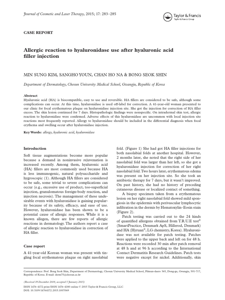 Allergic Reaction To Hyaluronidase Use After Hyaluronic Acid Filler