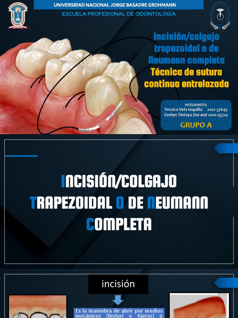 Incisión y Sutura en Odontología | PDF | Cirugía | Sutura Quirúrgica