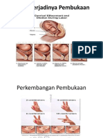 Proses Pembukaan Persalinan