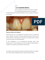 La Fluorosis Dental