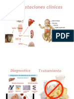 Galactosemia Diapositiva