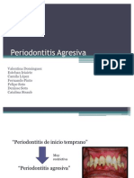 Periodontitis Agresiva