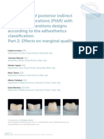 Comparison of Posterior Indirect Adhesive Restorations